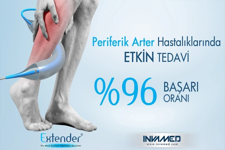 Bu yöntem periferik arter hastalığında yüzde 96 başarı sağlıyor