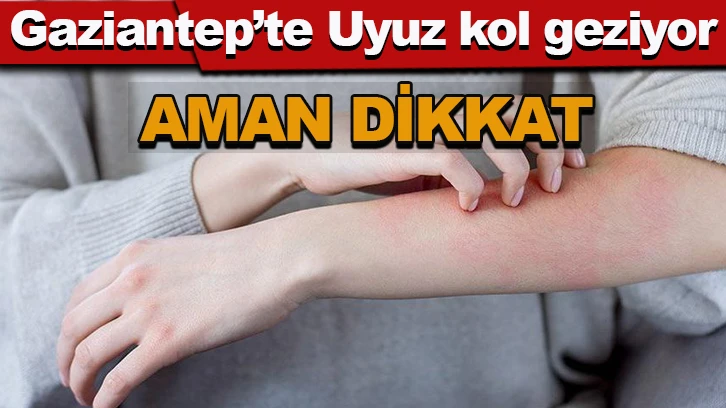 Gaziantep’te Uyuz kol geziyor