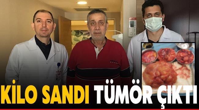 Kilo sandı tümör çıktı