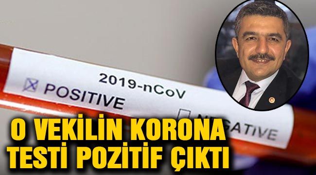 O vekilin Korona testi pozitif çıktı-