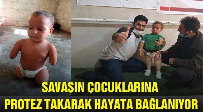 Savaşın çocuklarına protez takarak hayata bağlanıyor