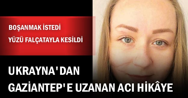 Ukrayna'dan Gaziantep'e Uzanan Acı Hikaye