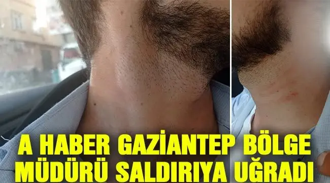 A Haber Gaziantep Bölge Müdürlüğü Ekipleri Saldırıya Uğradı