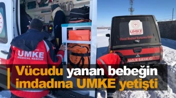 Vücudu yanan bebeğin imdadına UMKE yetişti